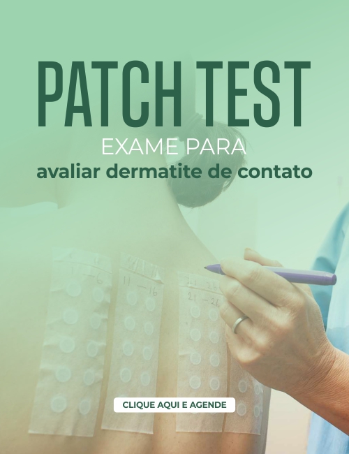 Exame de Alergia Patch Test Fortaleza