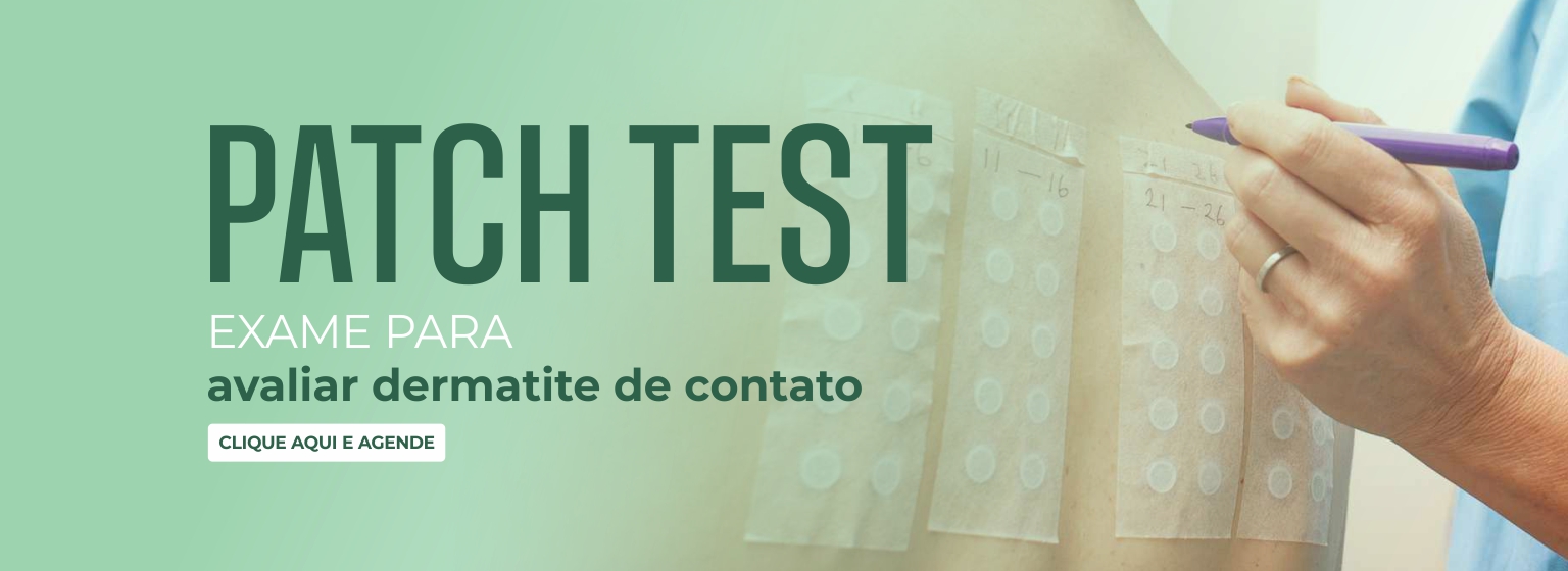 Exame de Alergia Patch Test em Fortaleza