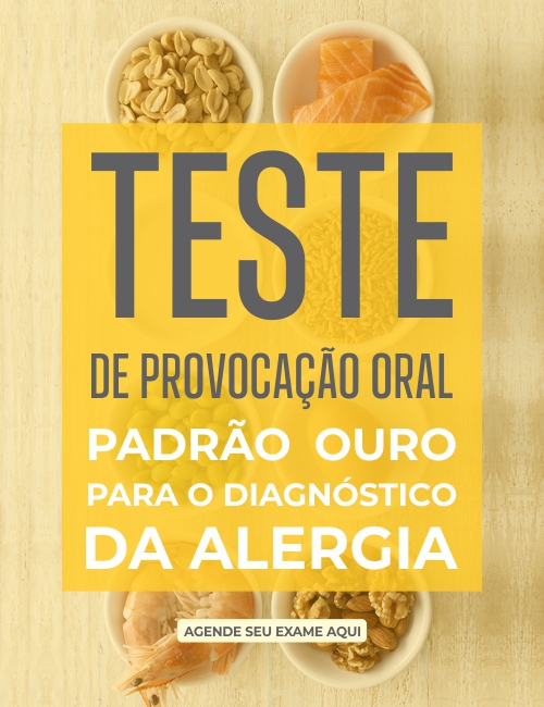 Teste de Provocação Oral Fortaleza