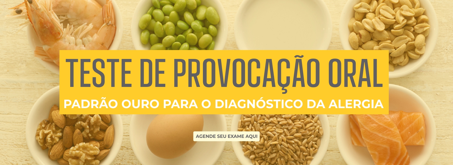 Teste de Provocação Oral em Fortaleza